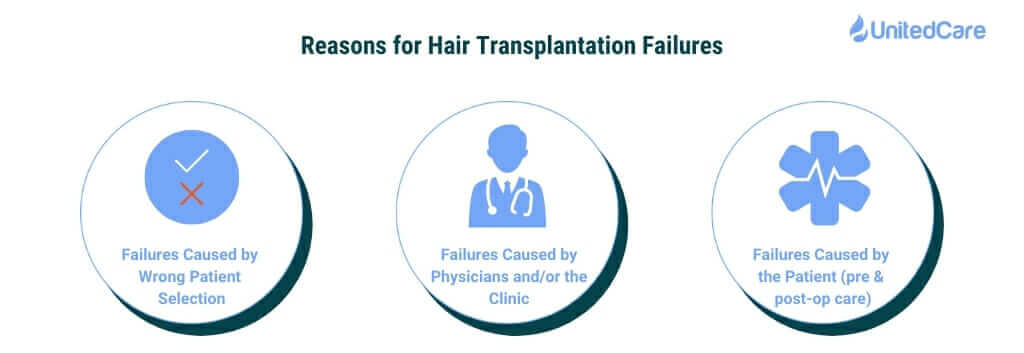 top three reasons of hair transplant failures