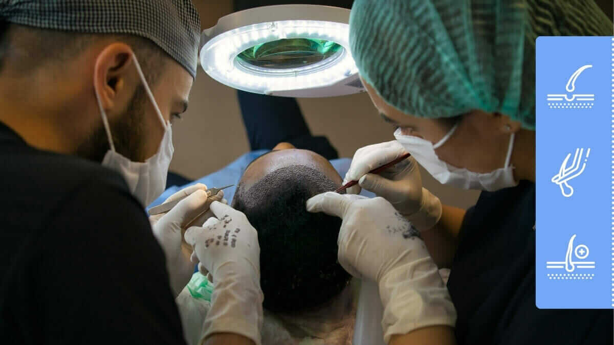 hair transplant surgery of Afro-American male