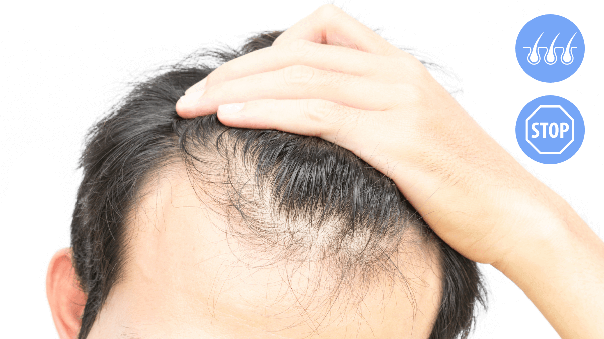 stop and prevent hair loss