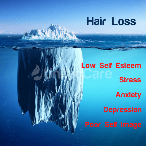 Hair loss is often just the visible symptom of deeper issues. Underneath the surface, there may be low self-esteem, stress, anxiety, depression, and a negative self-image.