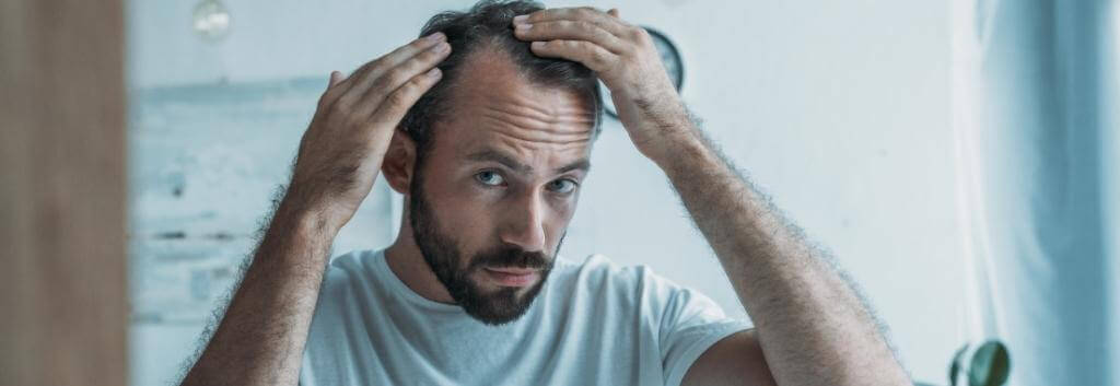 hair loss signs hairline