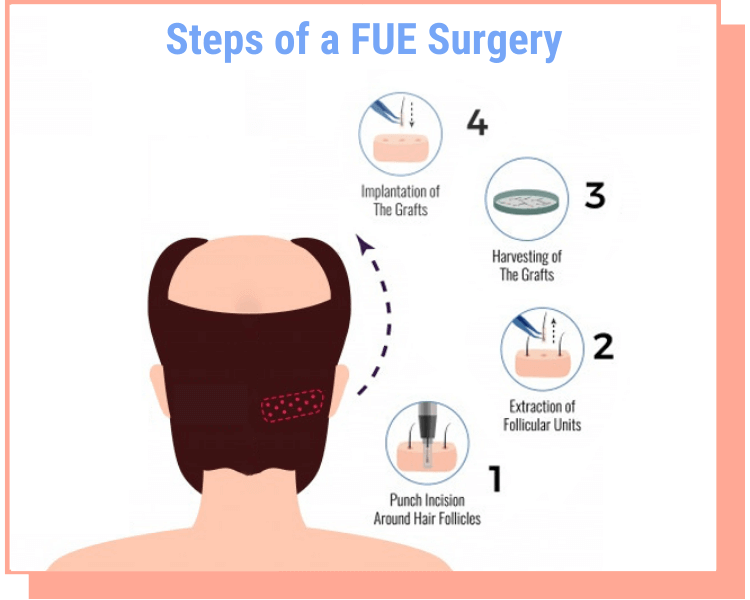 fue surgery process