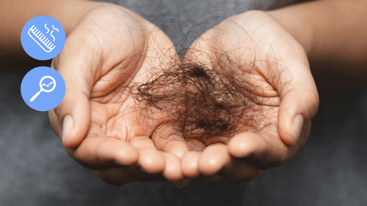 Types of Hair Fall Causes and Remedies  HealthKart