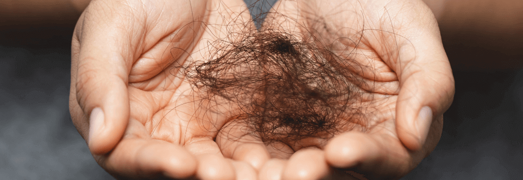 shedding pattern hair loss