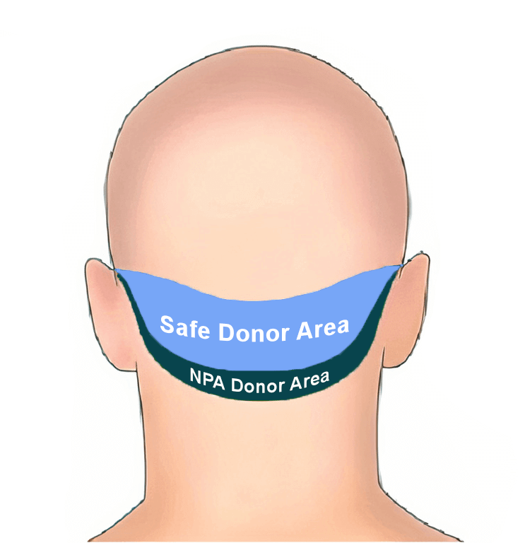 safe donor area