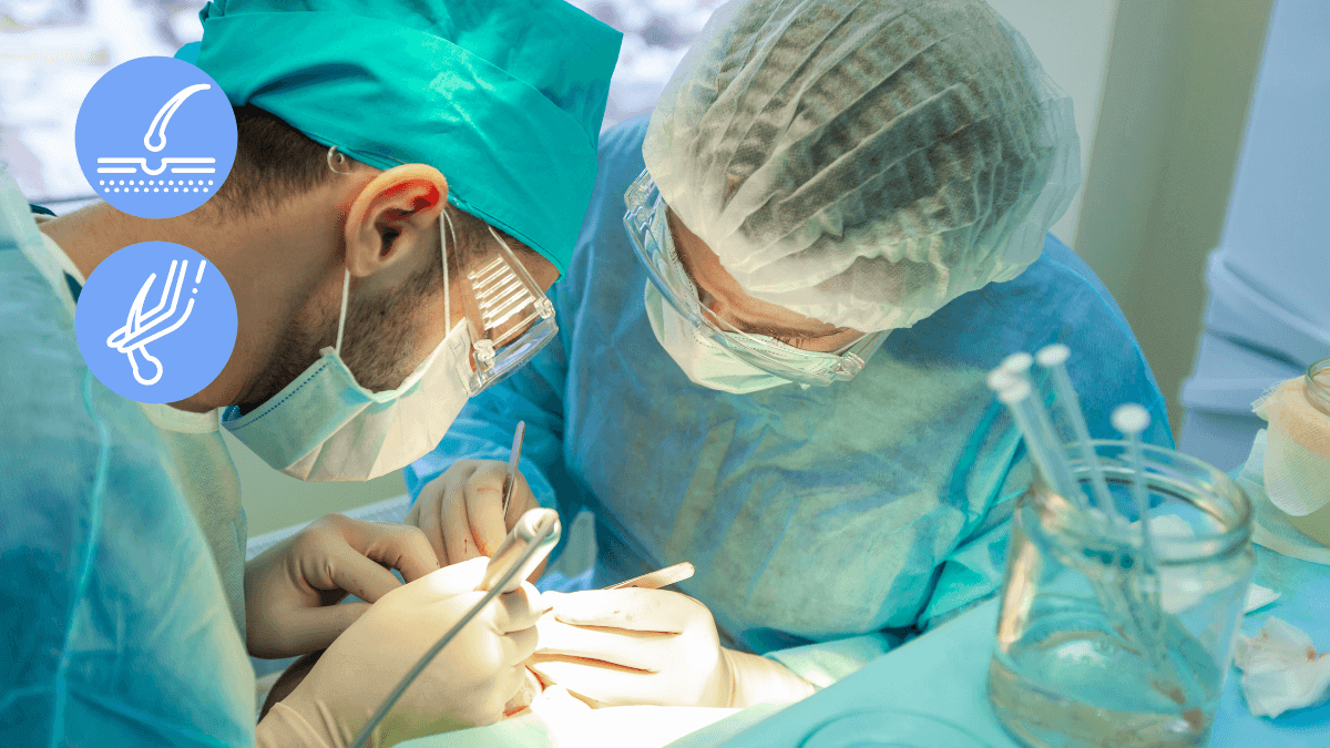 DHI Hair Transplant Explained - procedure, risks, cost, recovery DHI Hair Transplant Explained - procedure, risks, cost, recovery