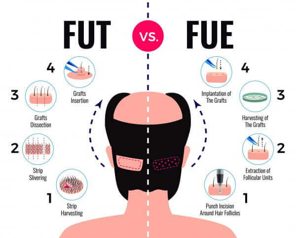 fut and fue scabs