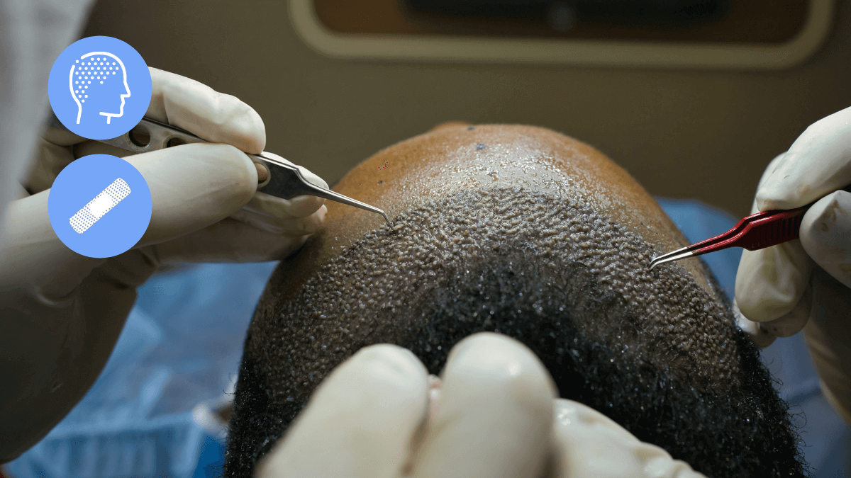 scabs after a hair transplant