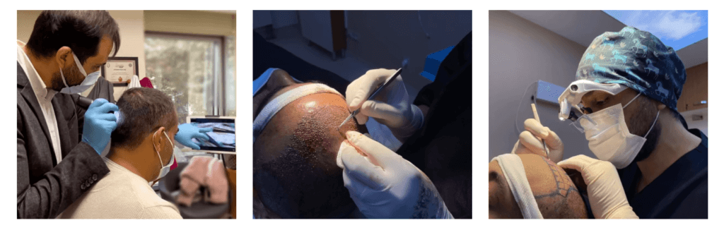 Stammzellen-Haartransplantationschirurg