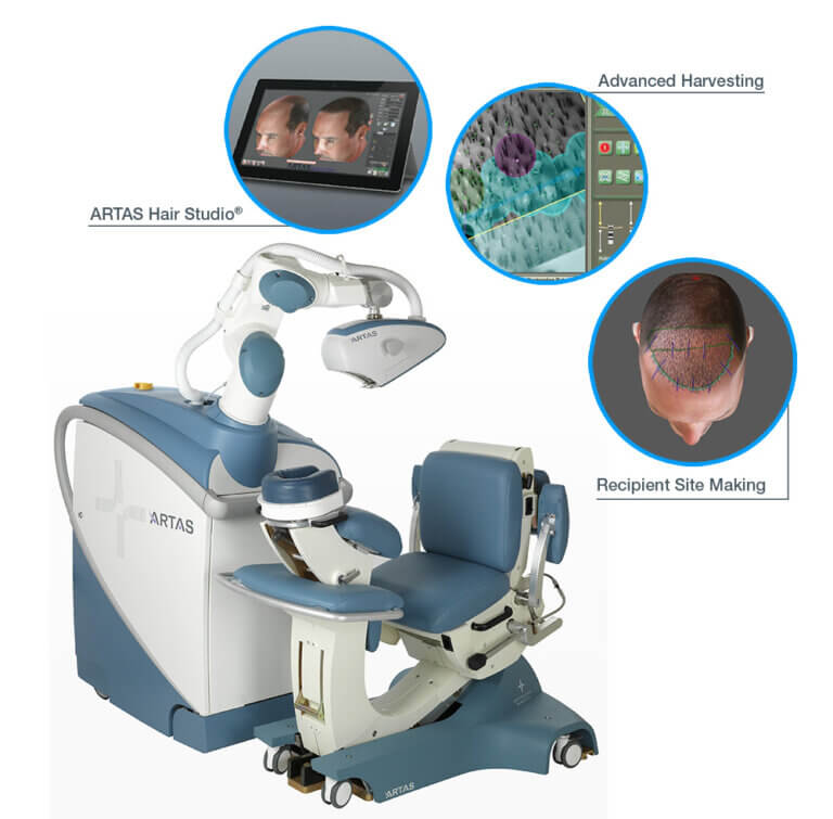 What Is ARTAS Robotic Hair Transplant and Is It Really Better?