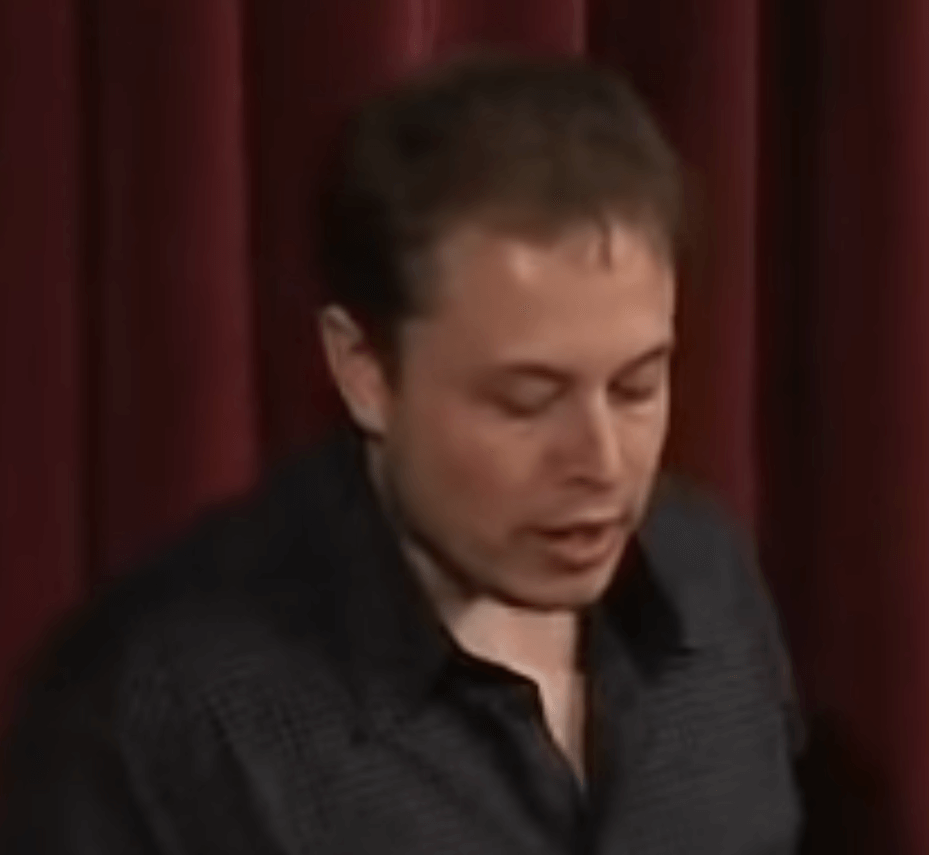 elon musk hair transplant 2003