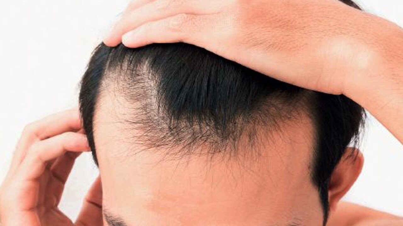Uneven Hairlines Why It Happens and How to Fix It