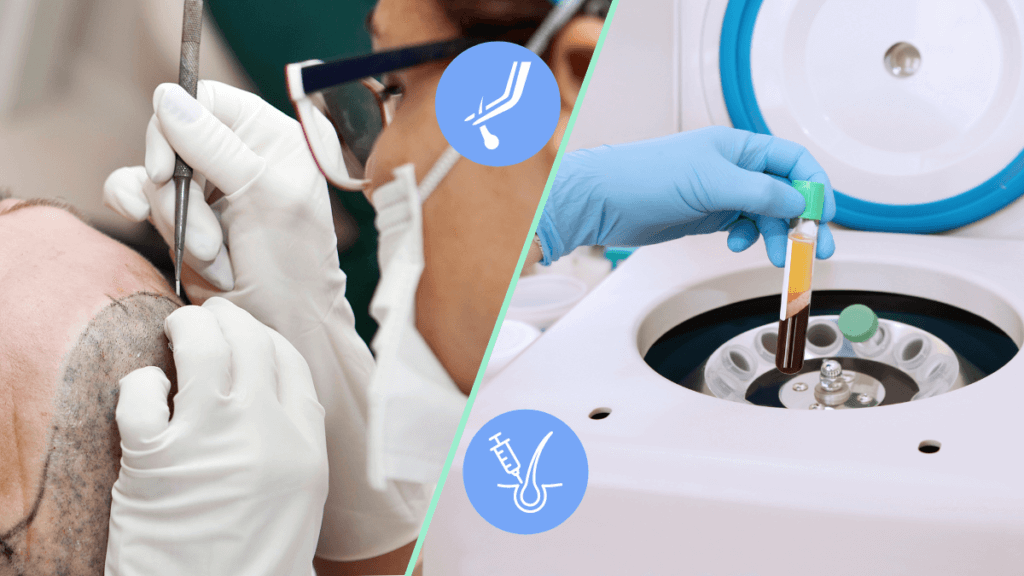 PRP vs. Hair Transplants which one is right for YOU