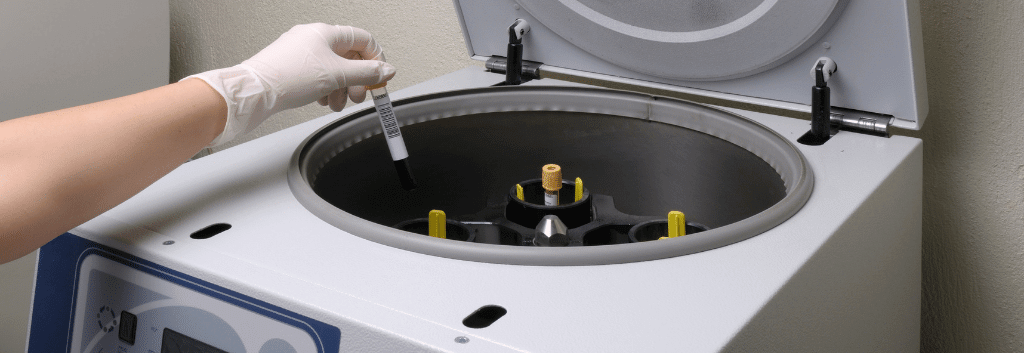 prp centrifugation