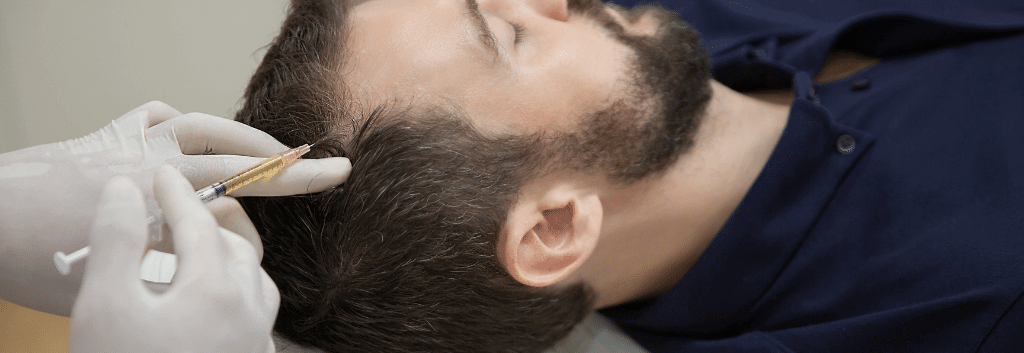 prp injection into scalp