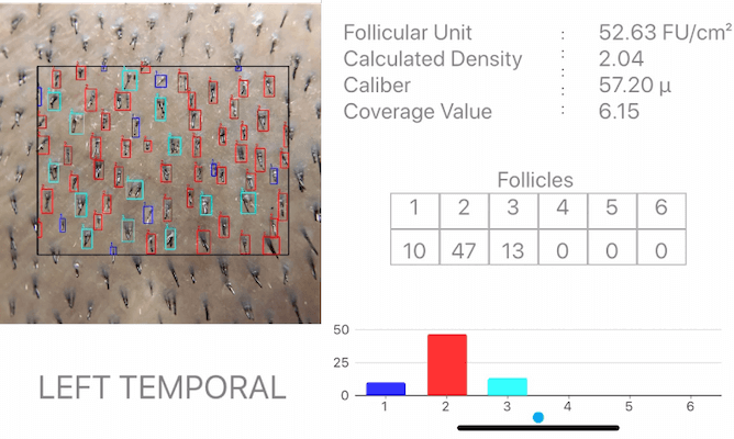 KE-Bot Mobile 3D Scanning System Output