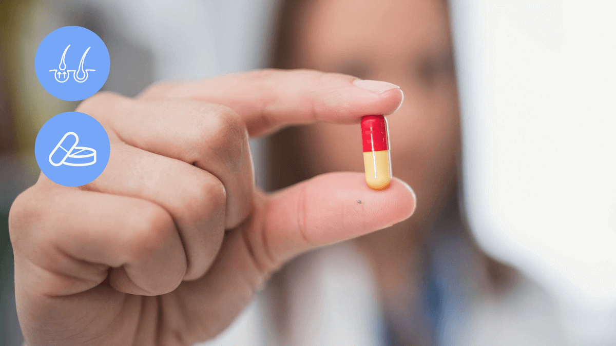Finasteride After a Hair Transplant - do you have to take it
