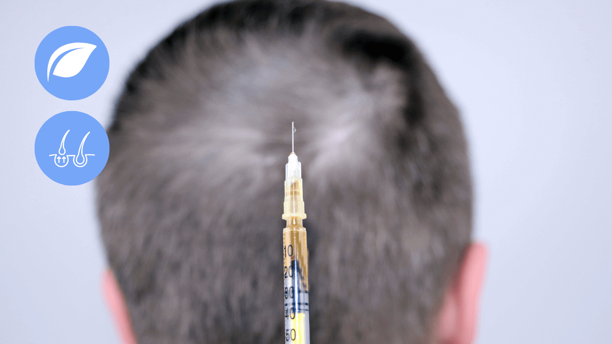 Alternatives to Hair Transplant Surgeries in 2022