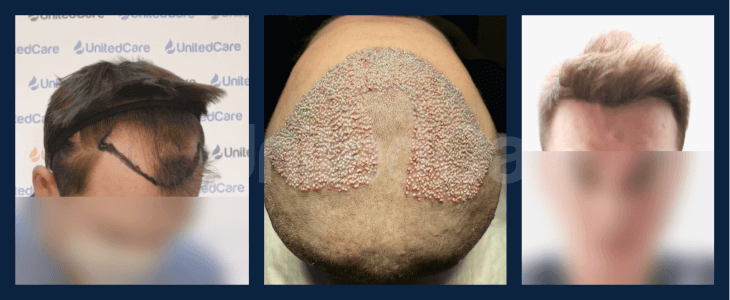 Before After - UnitedCare Before After - UnitedCare