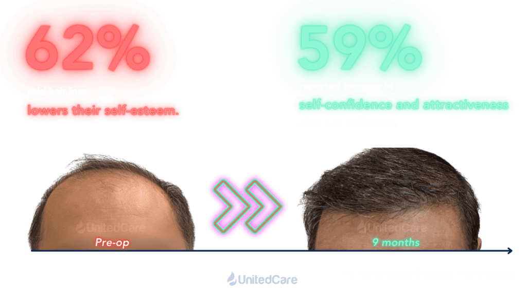 Männer Haartransplantation Umfrage Selbstwertgefühl und Attraktivität Ergebnis