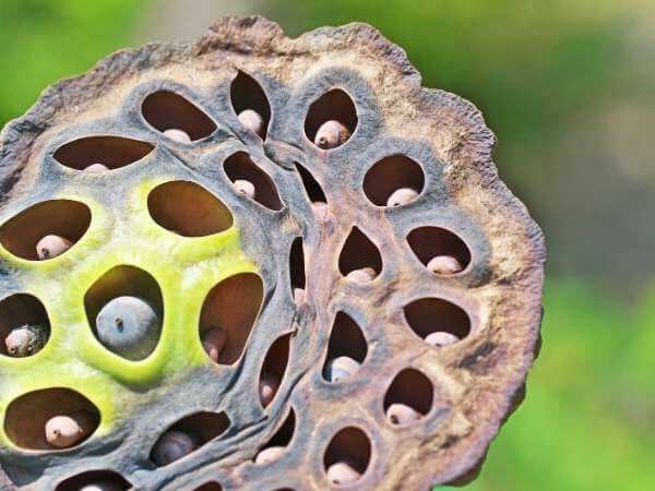 hair transplant trypophobia test image 4