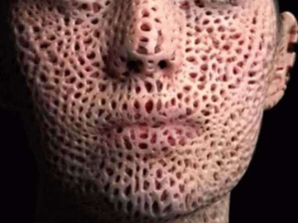 hair transplant trypophobia test image 5