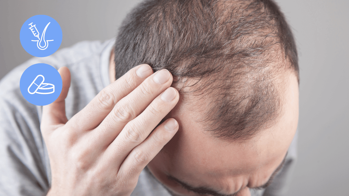Not All Hair Transplants Look Natural - Here Are 5 Steps to Avoid It