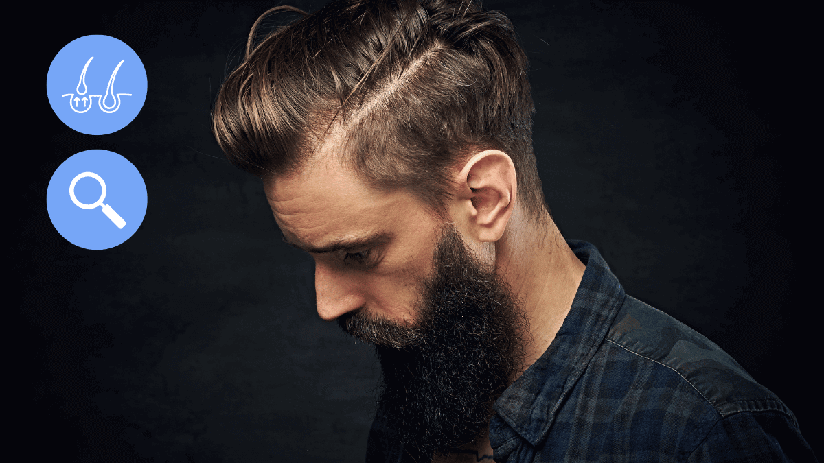 5 Ways to Hide Your Hair Transplant from the World