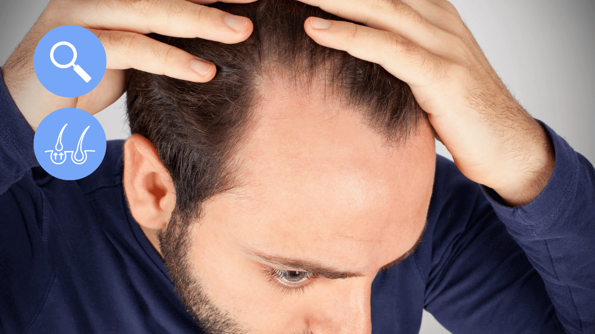 Temple Hair Loss - why it happens and how to fix it