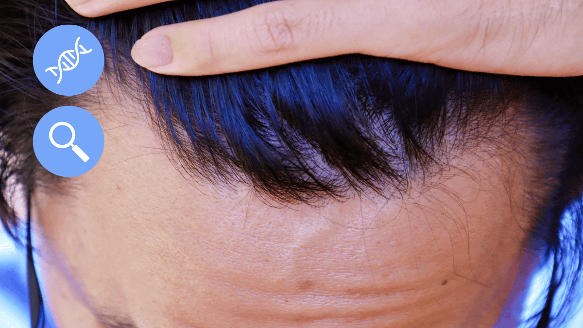 Widow's Peak Hairline - Identification, Causes, and Treatment