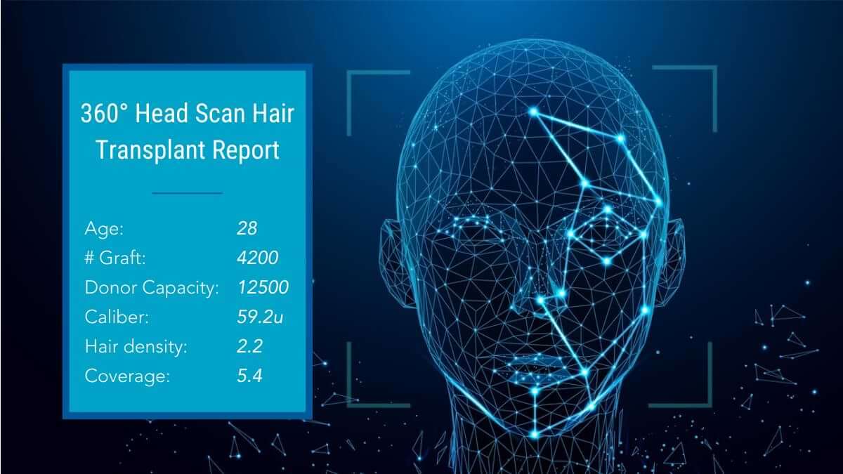 new hair transplant technology