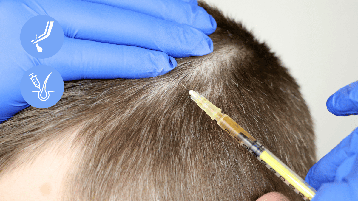 Painless or Pain-free Hair Transplant