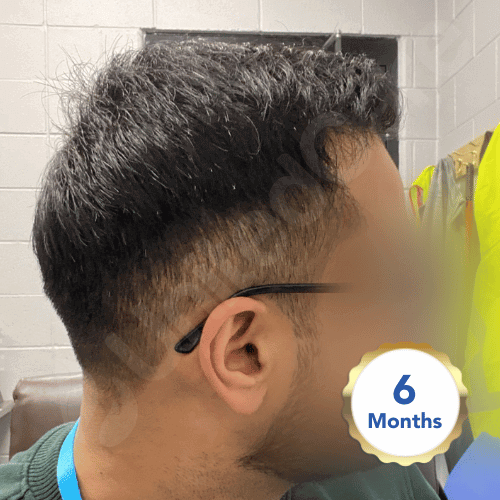 30 People With A Tragic Haircut As Shared By This Online Community |  DeMilked