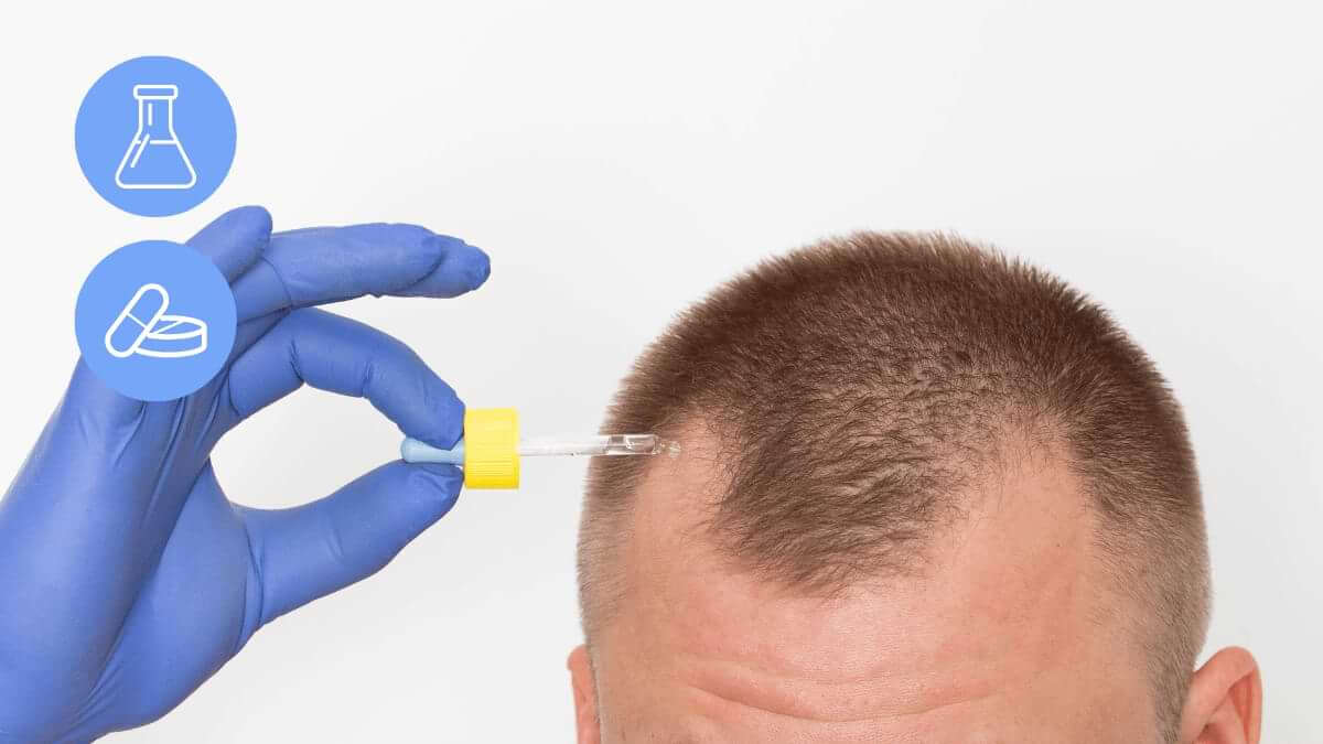 Finasteride vs. Minoxidil: What Does the Research Say?