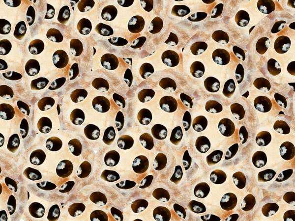 hair transplant trypophobia test image 3