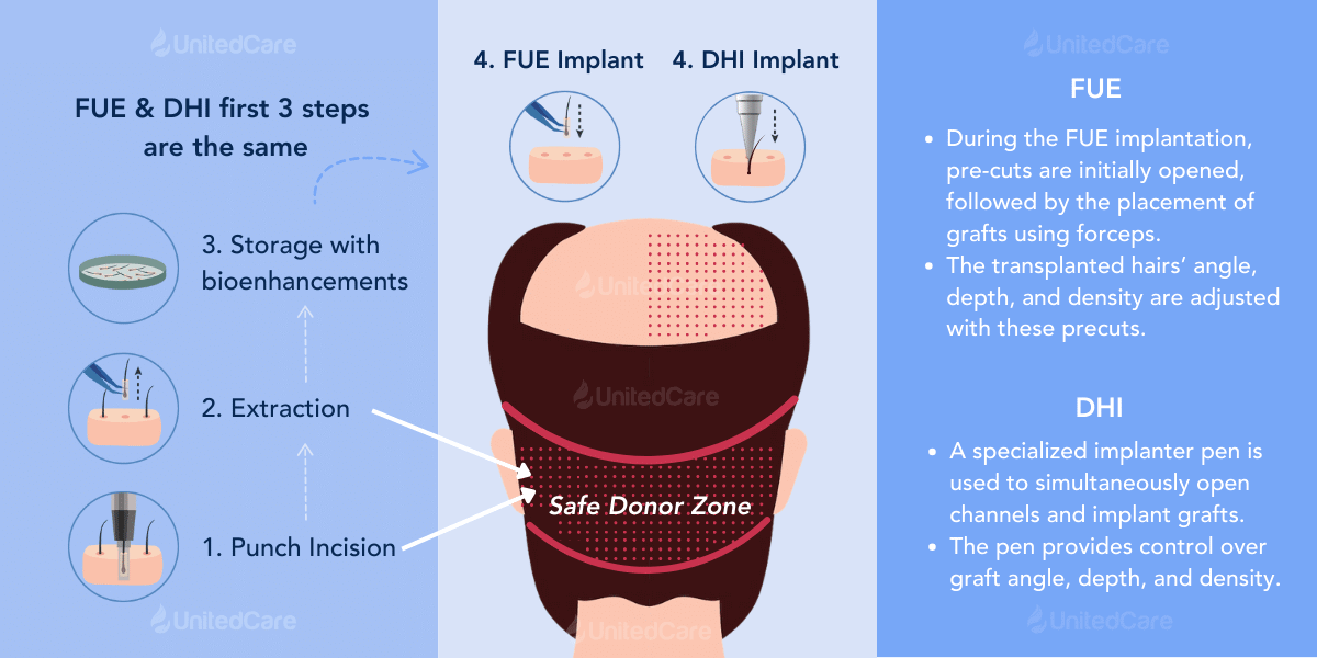 differences between DHI and FUE