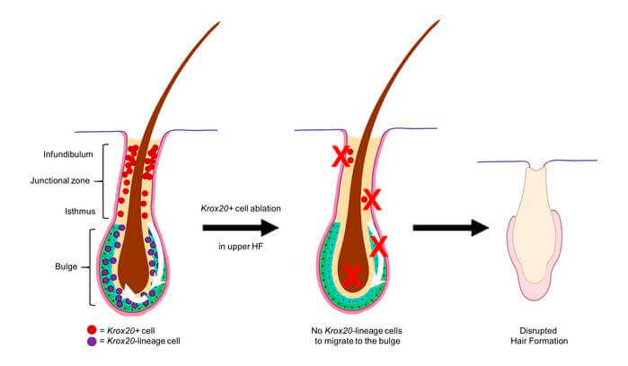 Stem cell migration to the bulb